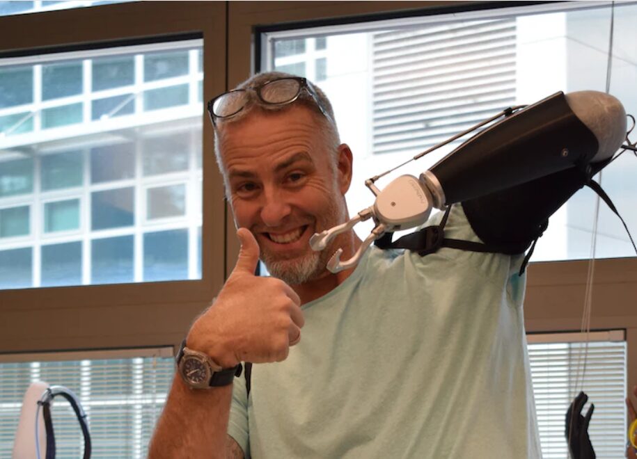 Marins Med provides new technology for amputees